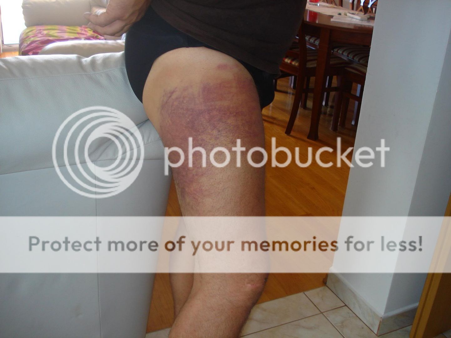 Motorcycle Travel Adventure - Elvis with bruised leg